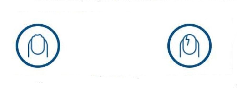 deformarea unghiilor din cauza infecției fungice